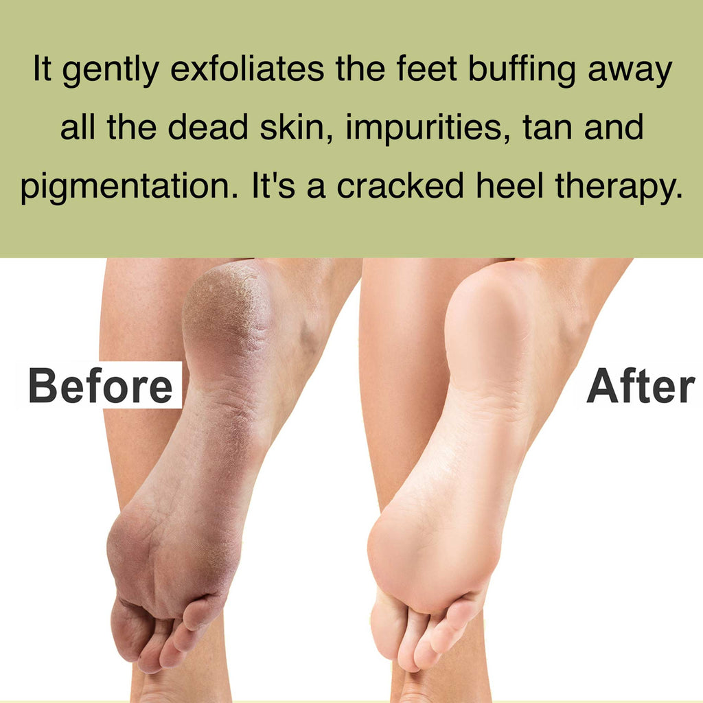 40G Anti-Drying Crack Foot Cream Hand Cracked Repair Cream Removal Dead  Skin Hand Feet Care Skin