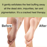 BodyHerbals Foot Exfoliating Kit